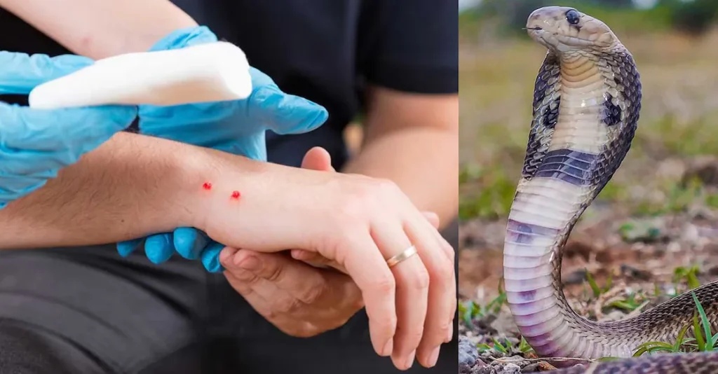 Snake Bite Treatment