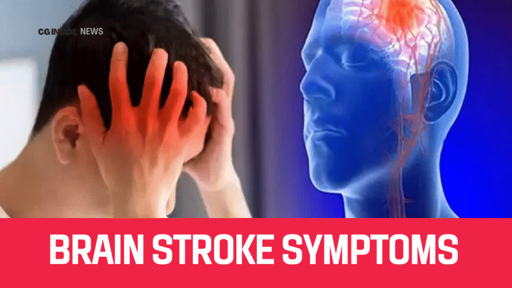 Brain Stroke Symptoms