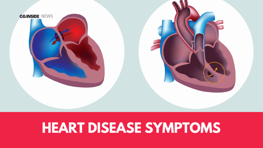 Heart Disease Symptoms