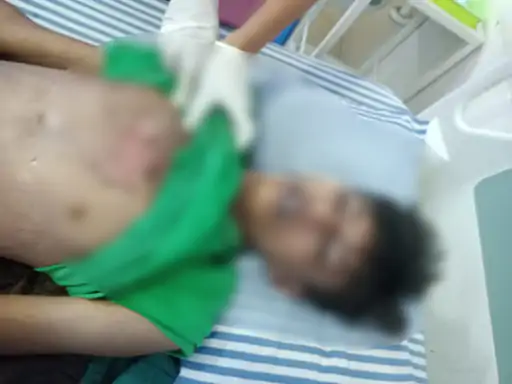 Raipur Lightning Incident