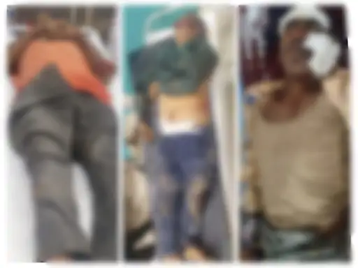 Accident In Dhamtari