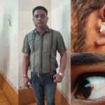 Navodaya Vidyalaya Students Beaten